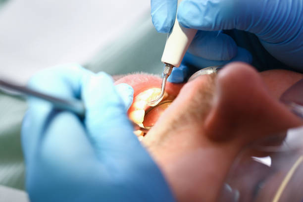 Best Pediatric Emergency Dentist in West Pasco, WA